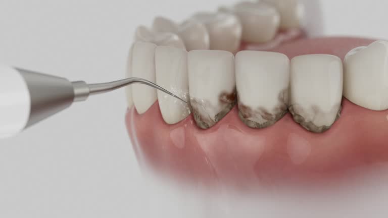 Reliable Dental Implants contractor in Thermal, CA by Smile Center Dentistry